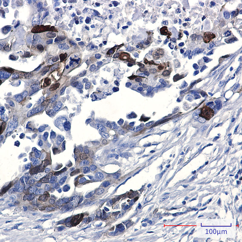 [KO]Phospho-NDRG1 (Ser330) Rabbit mAb ABZ4642