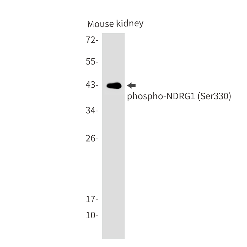 [KO]Phospho-NDRG1 (Ser330) Rabbit mAb ABZ4642