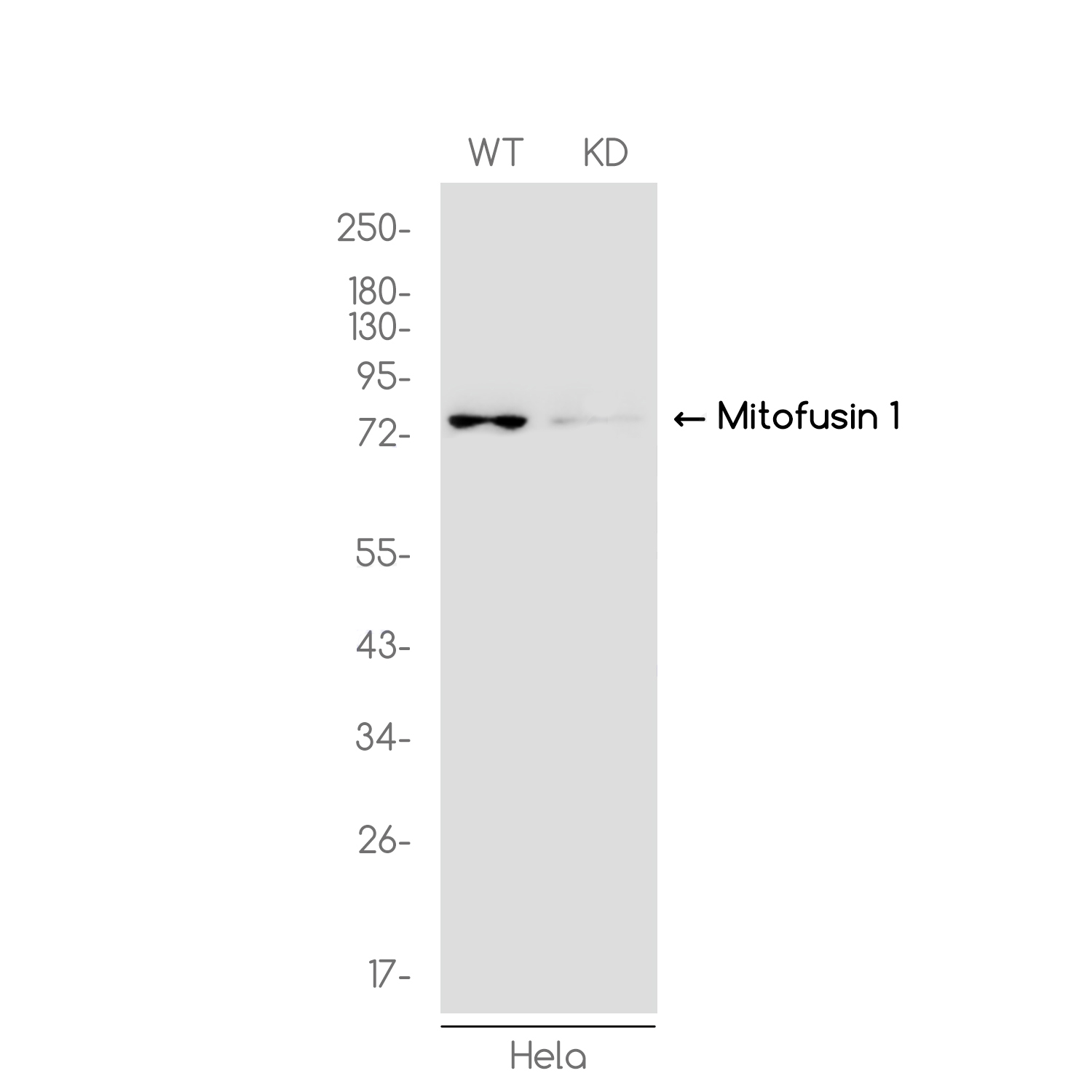 [KD]Mitofusin 1 Rabbit mAb ABZ4645