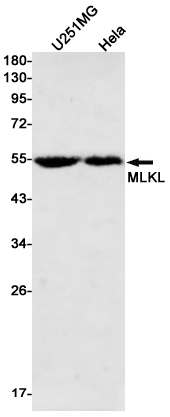 [KD]MLKL Rabbit mAb ABZ4646