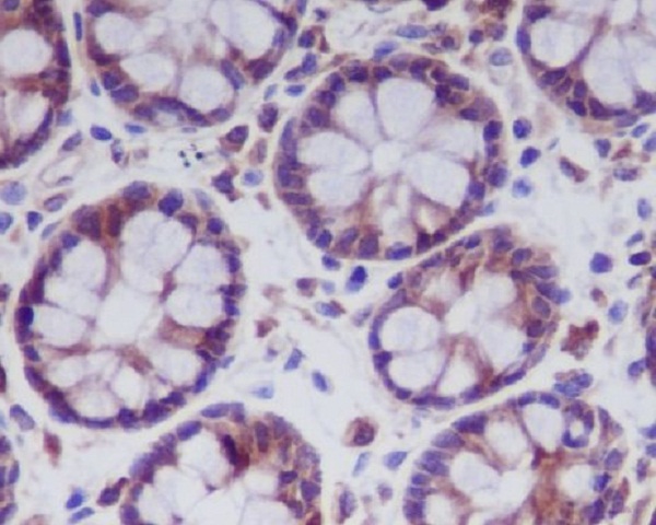 [KD]MLKL Rabbit mAb ABZ4647