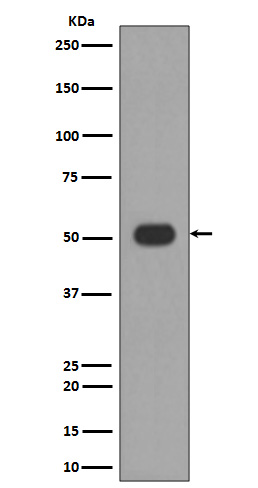 [KD]MLKL Rabbit mAb ABZ4647