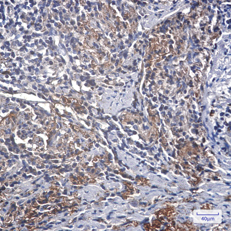 [KD]IGFBP7 Rabbit mAb ABZ4648