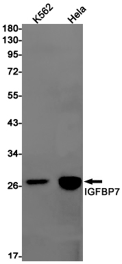 [KD]IGFBP7 Rabbit mAb ABZ4648