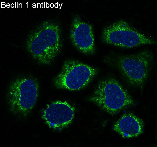 [KO]Beclin 1 Rabbit mAb ABZ4652