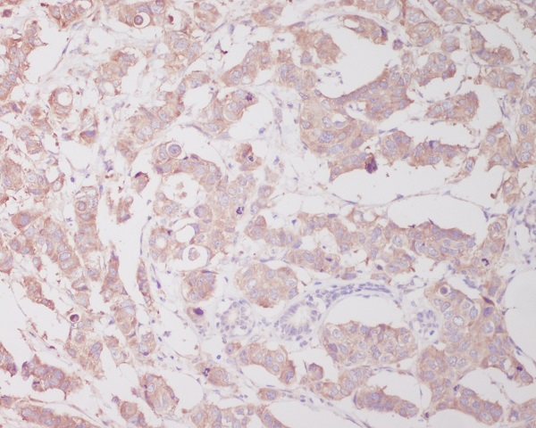 [KO]Beclin 1 Rabbit mAb ABZ4652