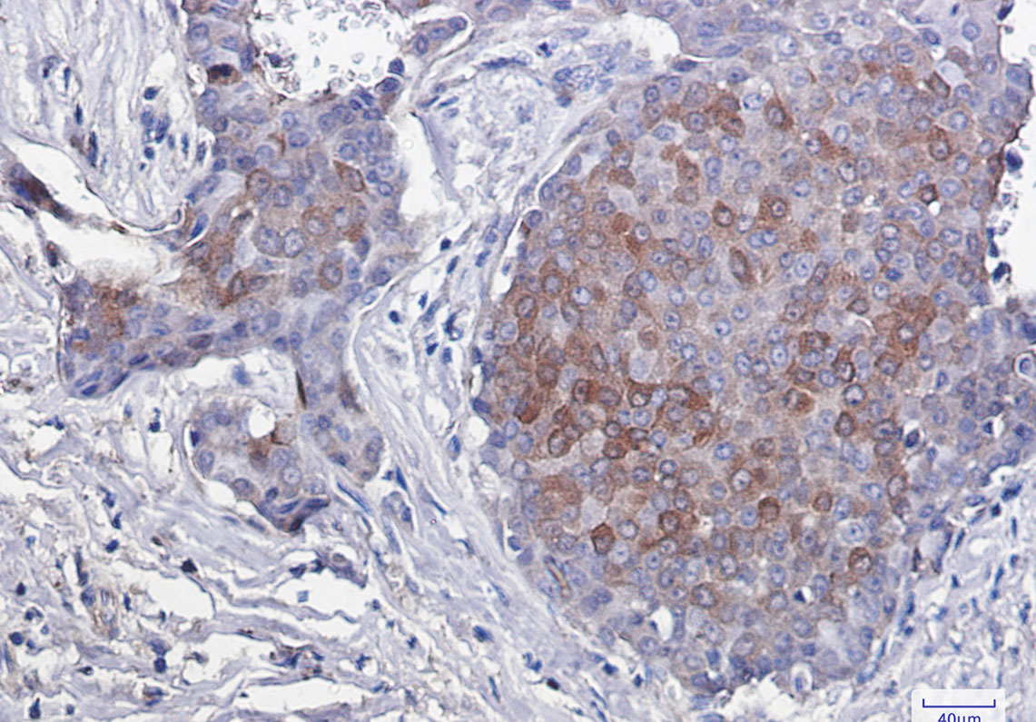 [KO]Phospho-4E BP1 (Thr46) Rabbit mAb ABZ4653
