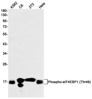 [KO]Phospho-4E BP1 (Thr46) Rabbit mAb ABZ4653