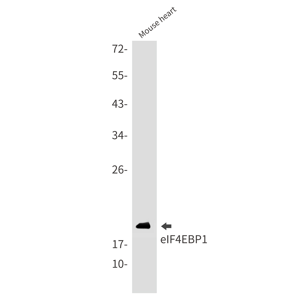 [KO]4E BP1 Rabbit mAb ABZ4654