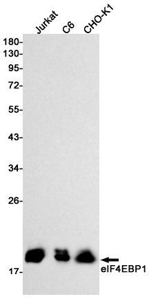 [KO]4E BP1 Rabbit mAb ABZ4654