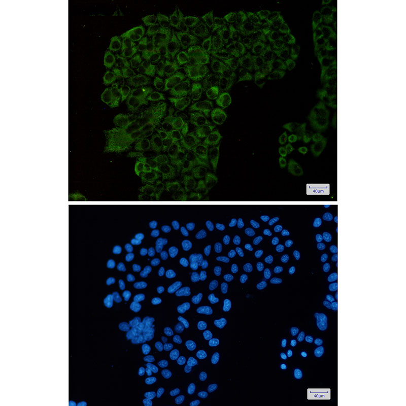 [KD]G3BP Rabbit mAb ABZ4655