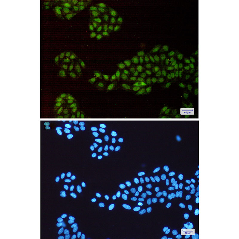 [KD]p150 CAF1 Rabbit mAb ABZ4657