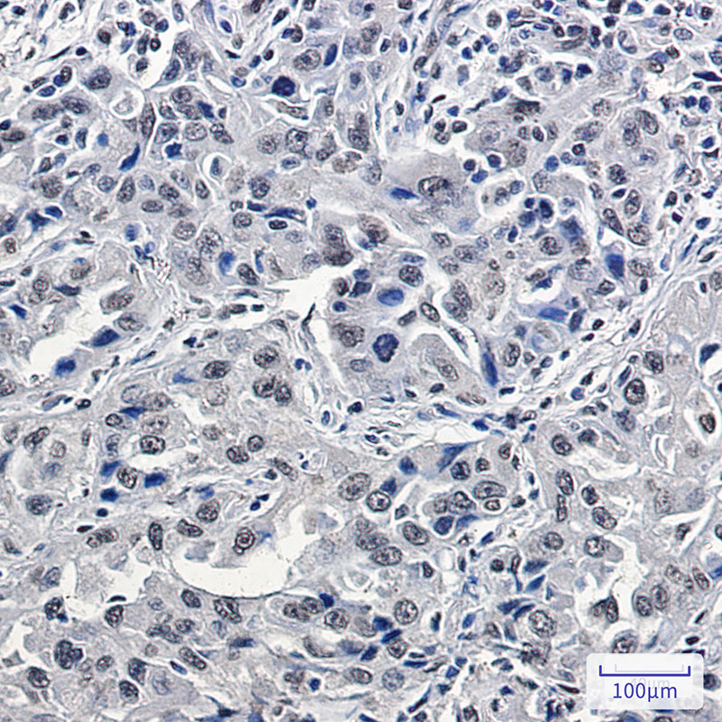 [KD]p150 CAF1 Rabbit mAb ABZ4657