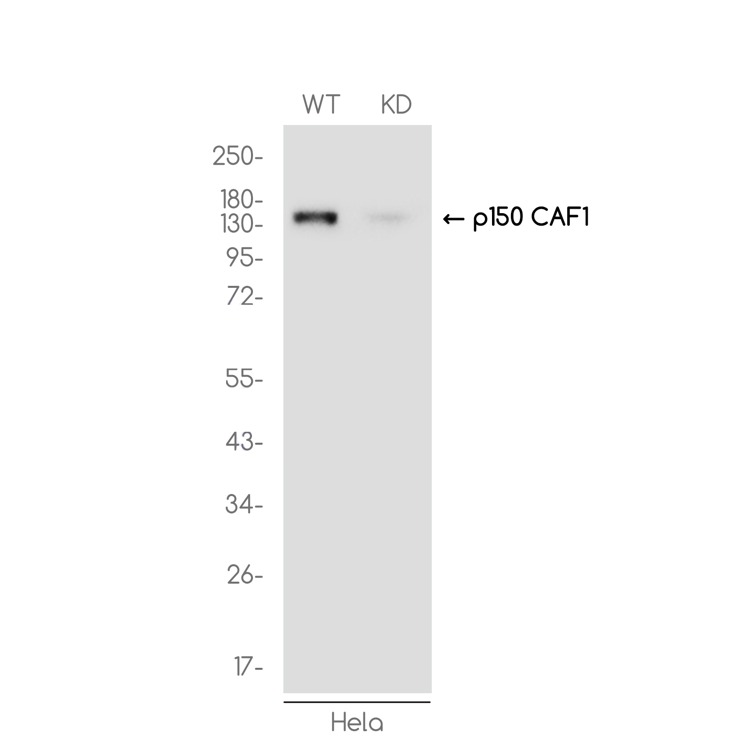 [KD]p150 CAF1 Rabbit mAb ABZ4657