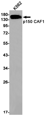 [KD]p150 CAF1 Rabbit mAb ABZ4657