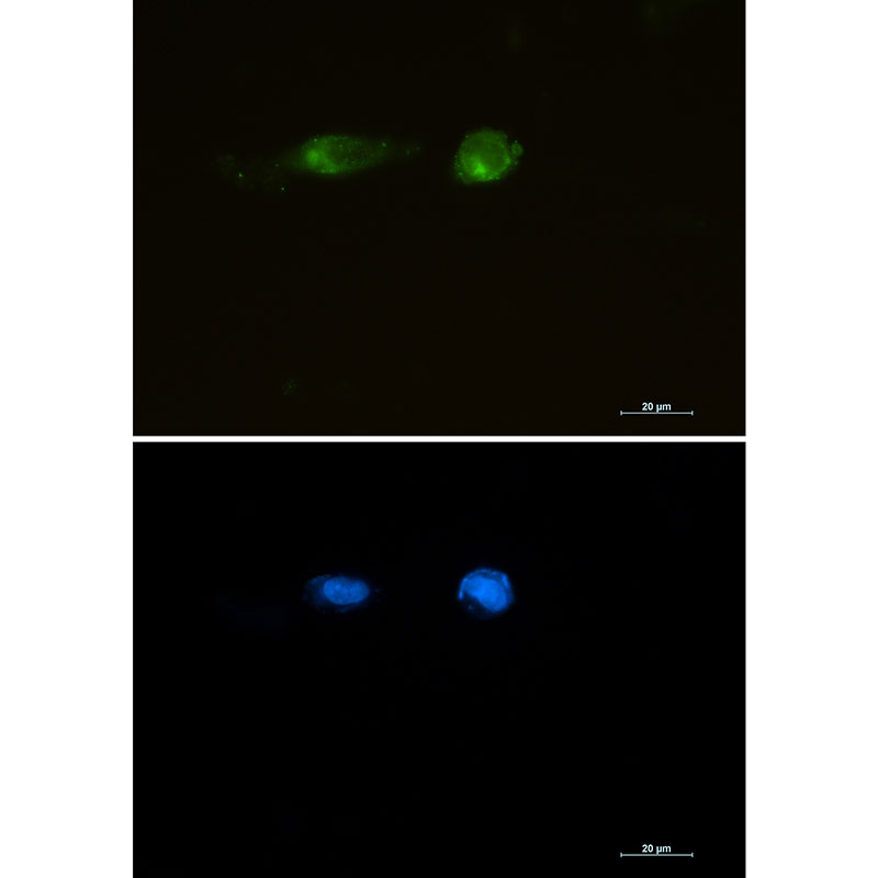 [KO]LRP1 Rabbit mAb ABZ4658