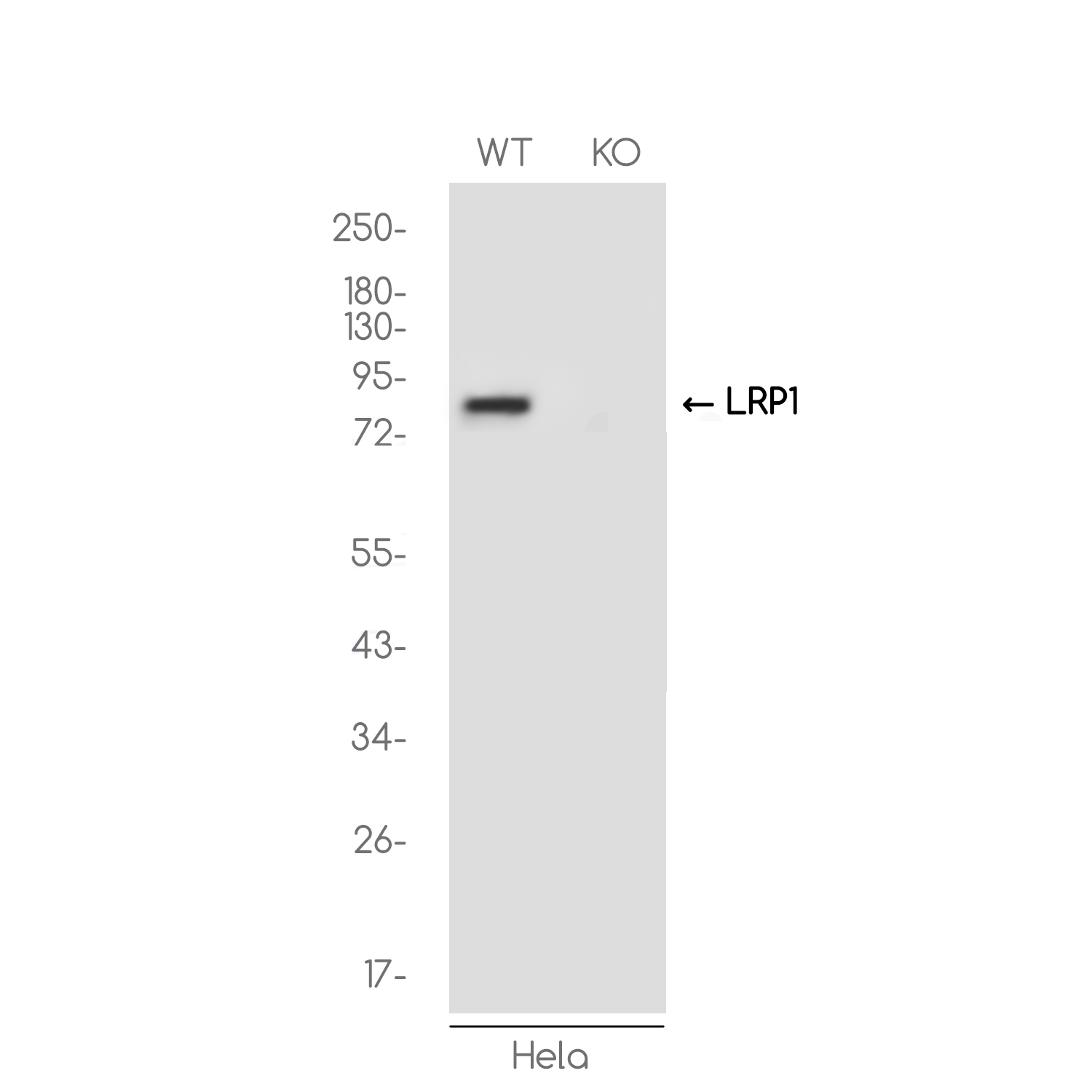 [KO]LRP1 Rabbit mAb ABZ4658