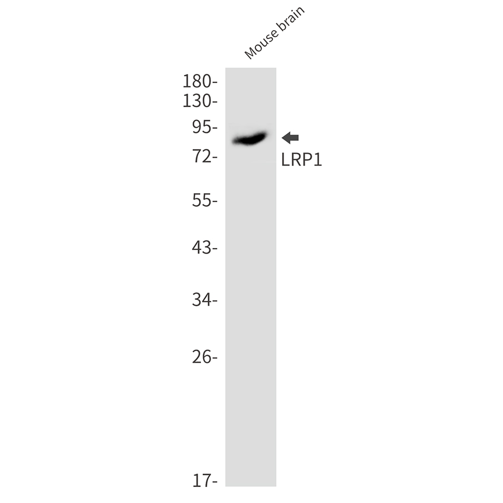 [KO]LRP1 Rabbit mAb ABZ4658
