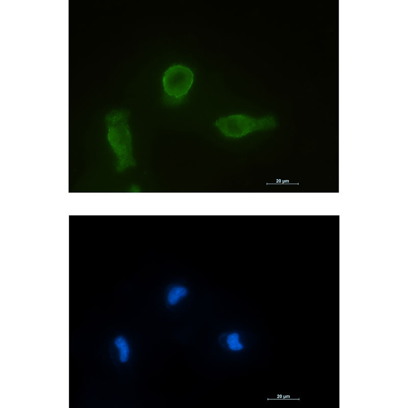 [KO]Bcl-XL Rabbit mAb ABZ4659