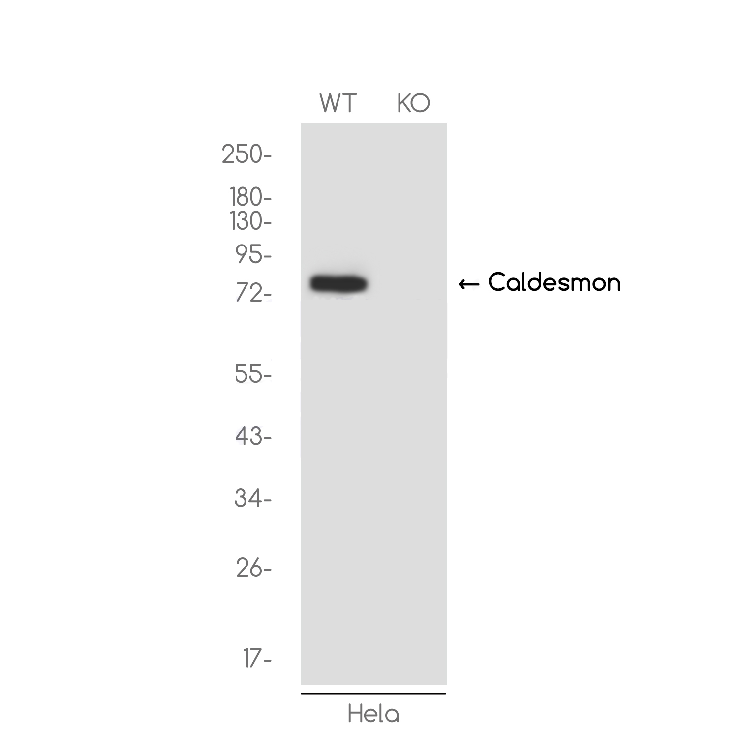[KO]Caldesmon/CDM Rabbit mAb ABZ4661