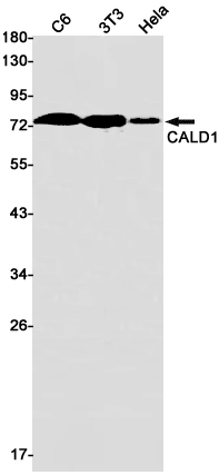 [KO]Caldesmon/CDM Rabbit mAb ABZ4661