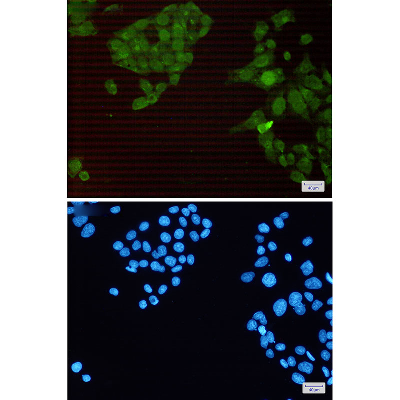 [KO]Phospho-HSF1 (Ser326) Rabbit mAb ABZ4663