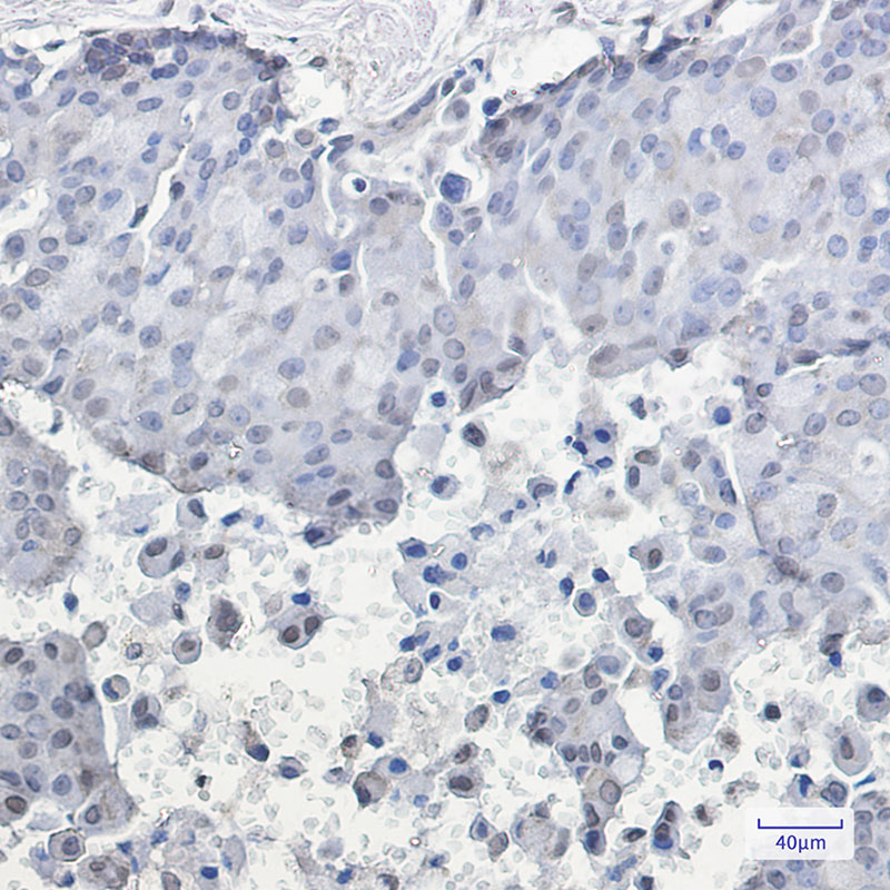 [KO]Phospho-HSF1 (Ser326) Rabbit mAb ABZ4663