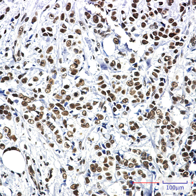 [KO]HSF1 Rabbit mAb ABZ4664