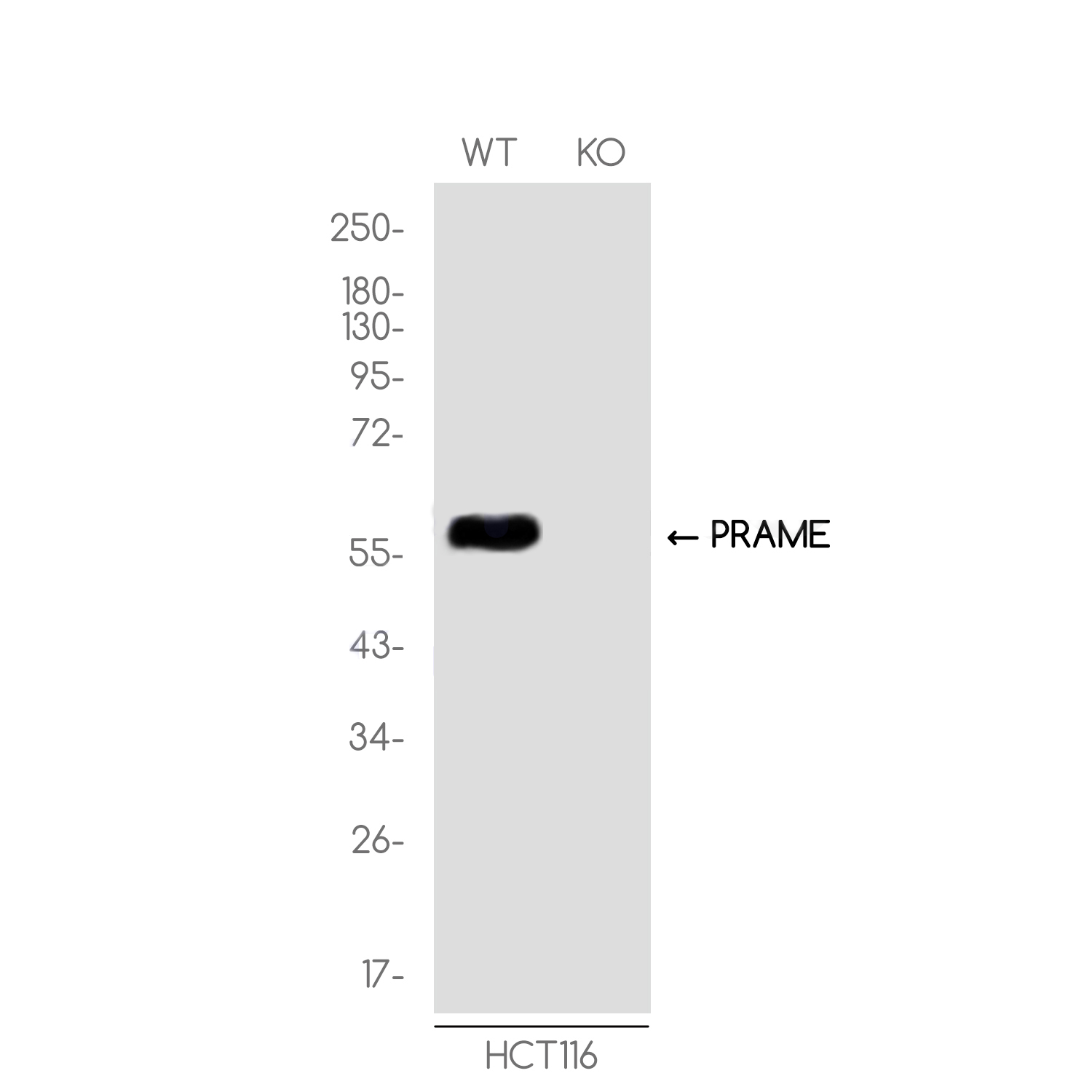 [KO]PRAME Rabbit mAb ABZ4665