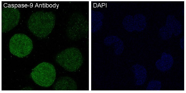 [KD]Cleaved-Caspase 9 Rabbit mAb ABZ4670
