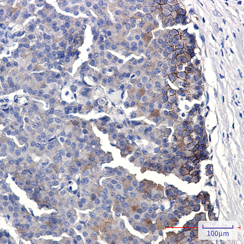 [KO]Eph receptor B4/HTK Rabbit mAb ABZ4671