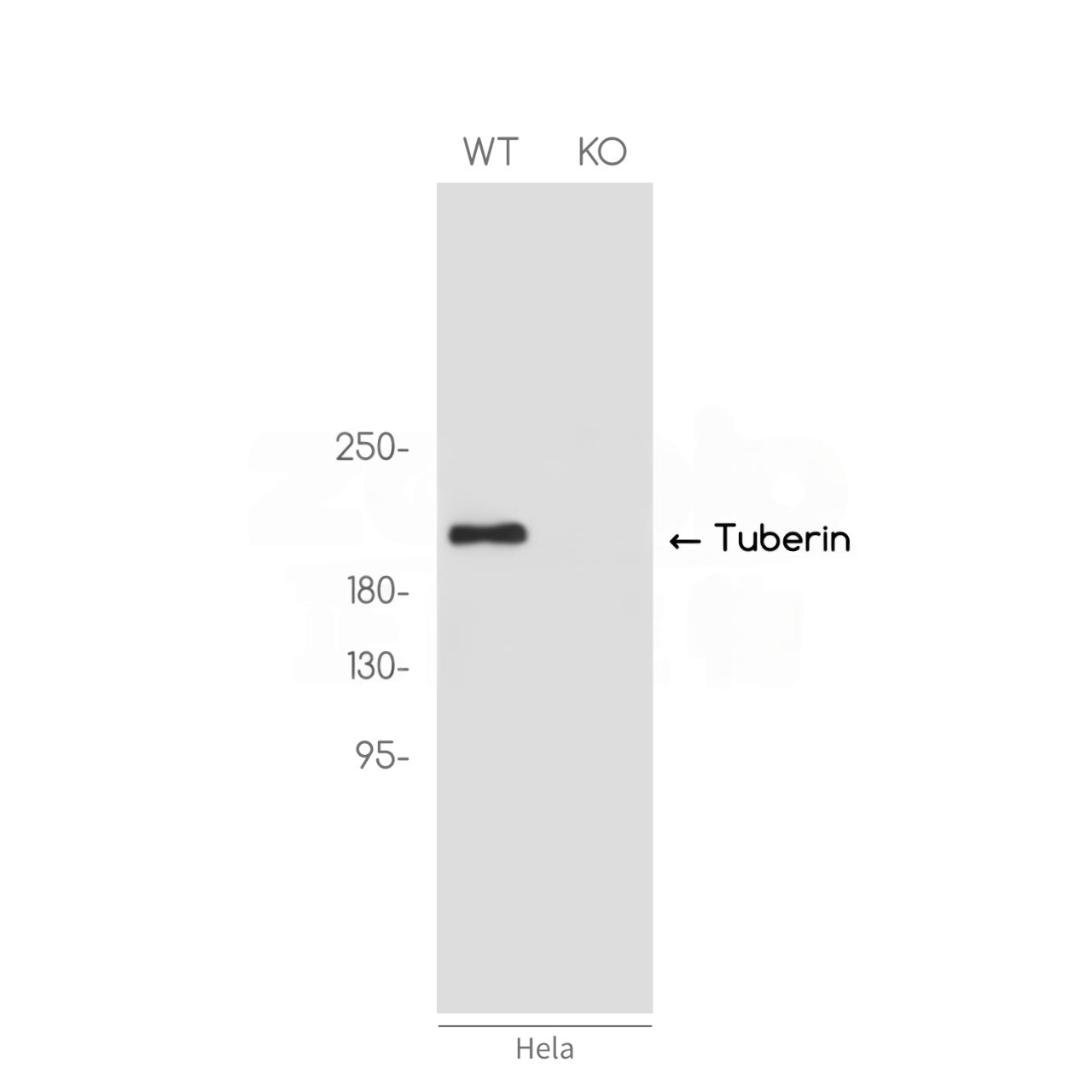 [KO]Tuberin Rabbit mAb ABZ4673