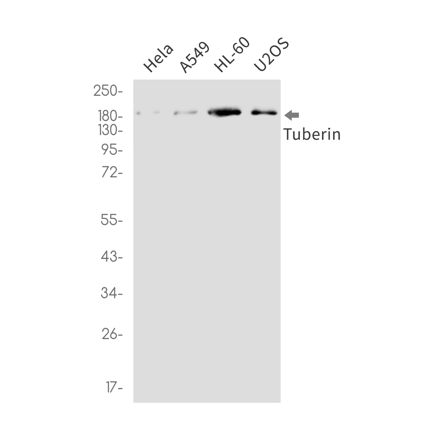 [KO]Tuberin Rabbit mAb ABZ4673