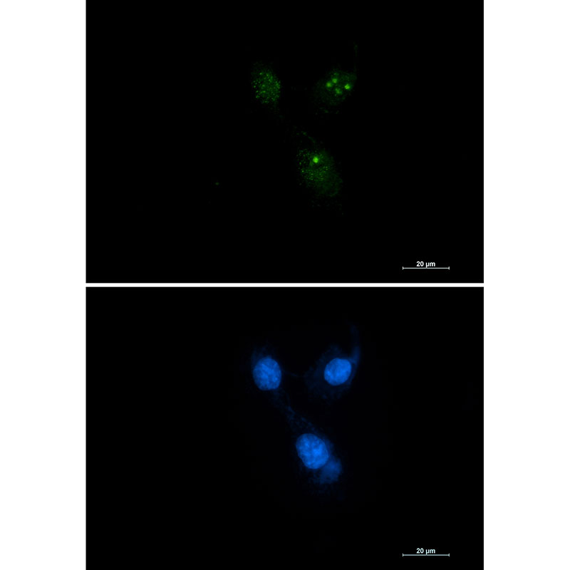 [KD]Presenilin 1 Rabbit mAb ABZ4674
