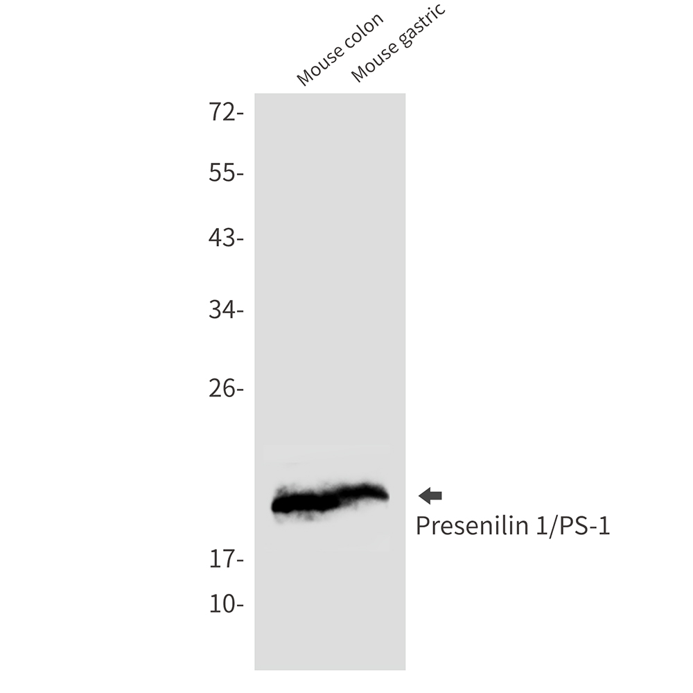 [KD]Presenilin 1 Rabbit mAb ABZ4674