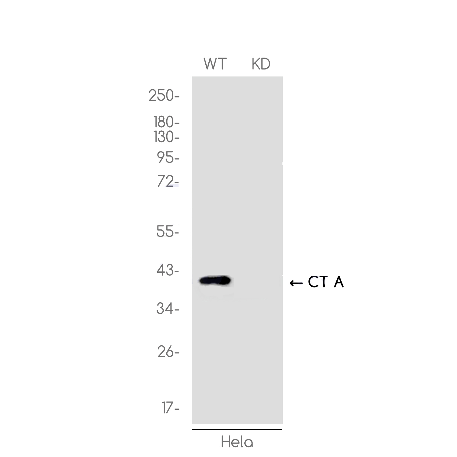 [KD]CT A Rabbit mAb ABZ4676