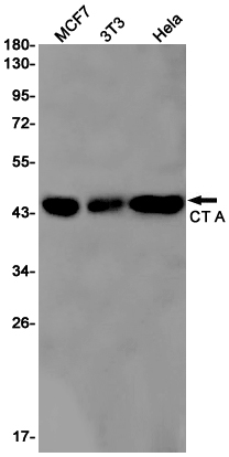 [KD]CT A Rabbit mAb ABZ4676