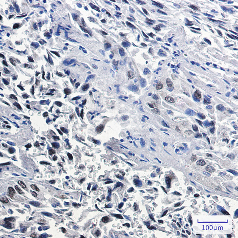 [KO]Thyroid Transcription Factor 1 Rabbit mAb ABZ4678