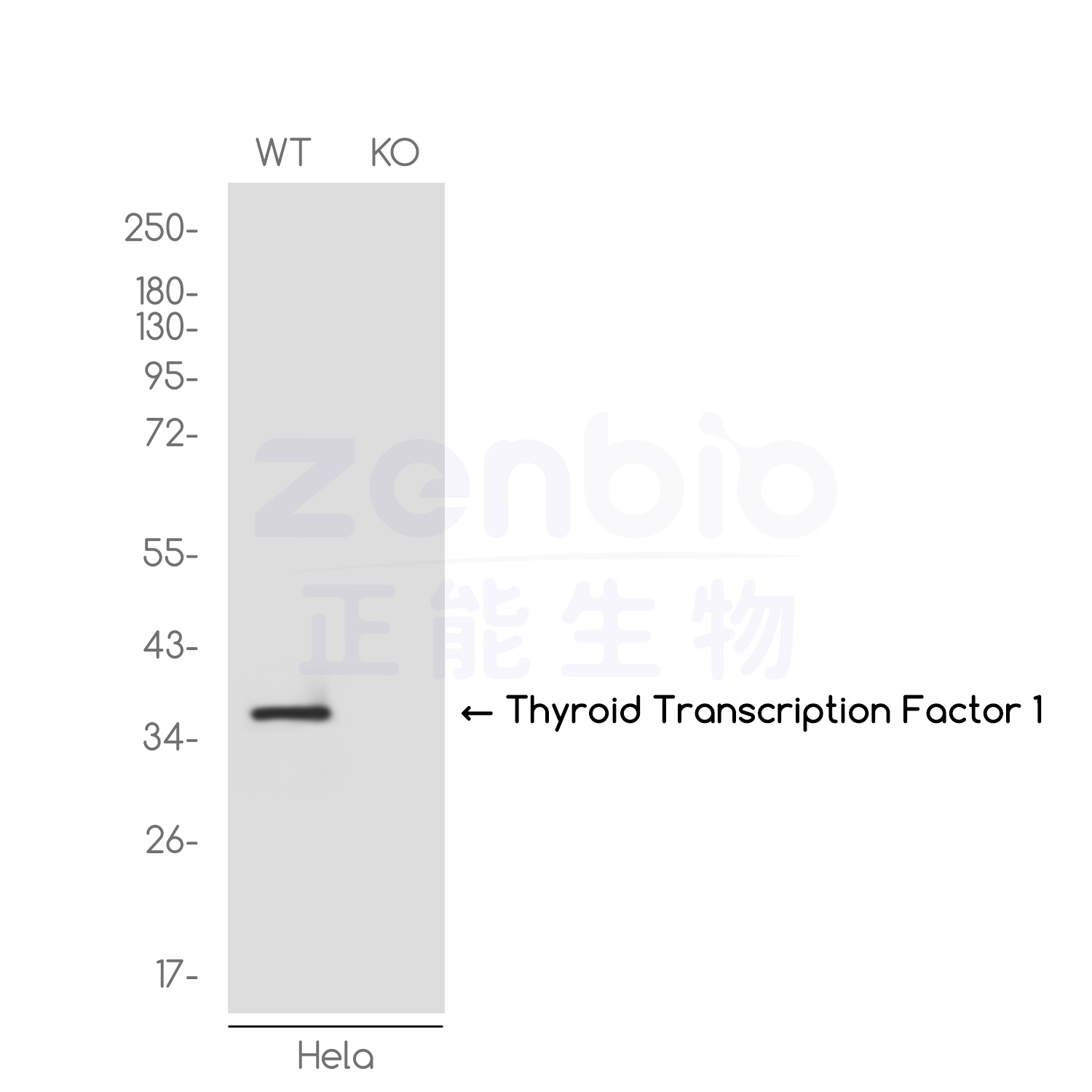 [KO]Thyroid Transcription Factor 1 Rabbit mAb ABZ4678