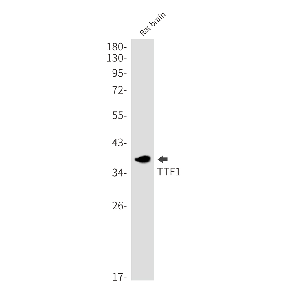 [KO]Thyroid Transcription Factor 1 Rabbit mAb ABZ4678