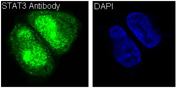 [KO]STAT3 Rabbit mAb ABZ4681