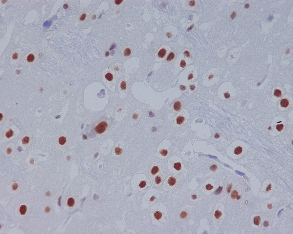 [KO]STAT3 Rabbit mAb ABZ4681