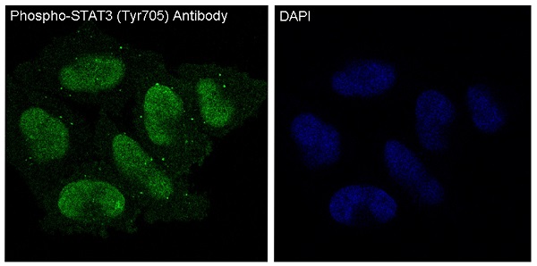 [KO]Phospho-STAT3 (Tyr705) Rabbit mAb ABZ4682