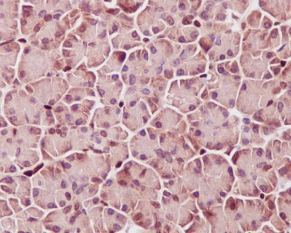[KO]Phospho-STAT3 (Tyr705) Rabbit mAb ABZ4682
