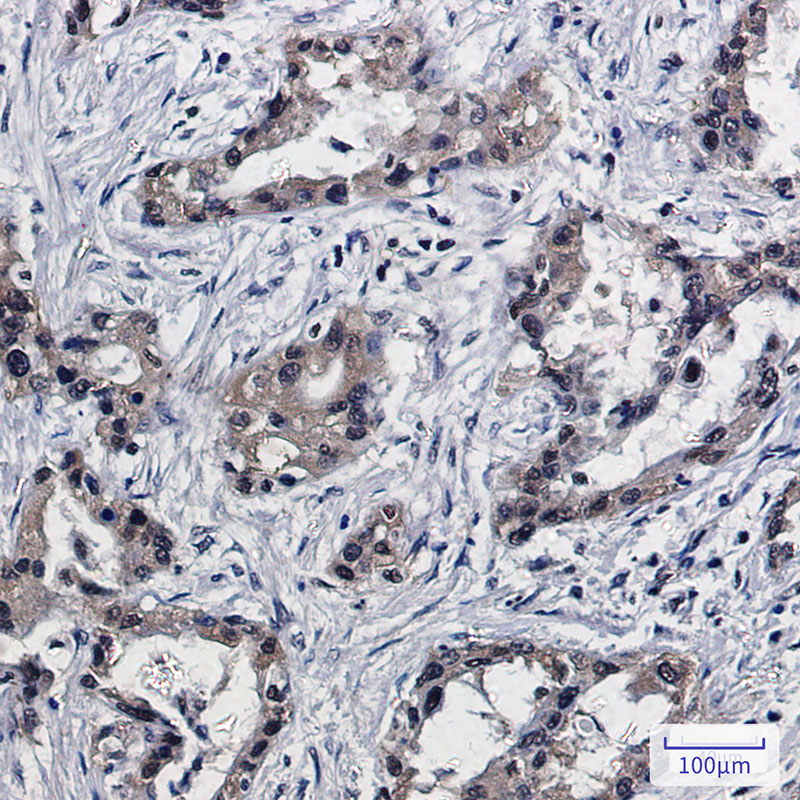 [KO]PSMB10/MECL1 Rabbit mAb ABZ4683