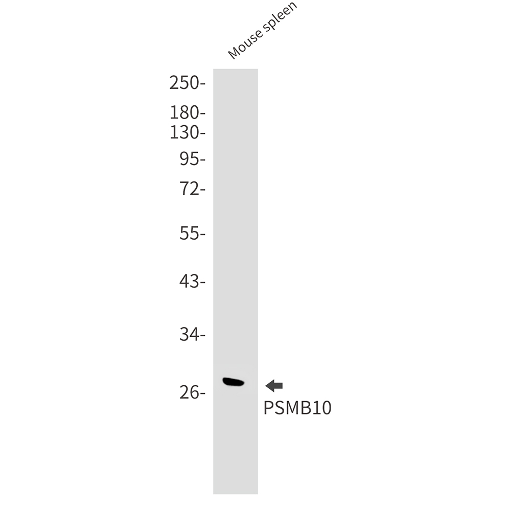[KO]PSMB10/MECL1 Rabbit mAb ABZ4683