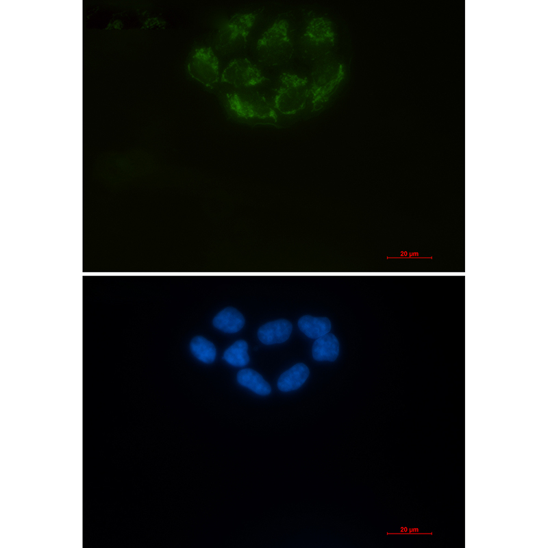 [KD]CD147 Rabbit mAb ABZ4685