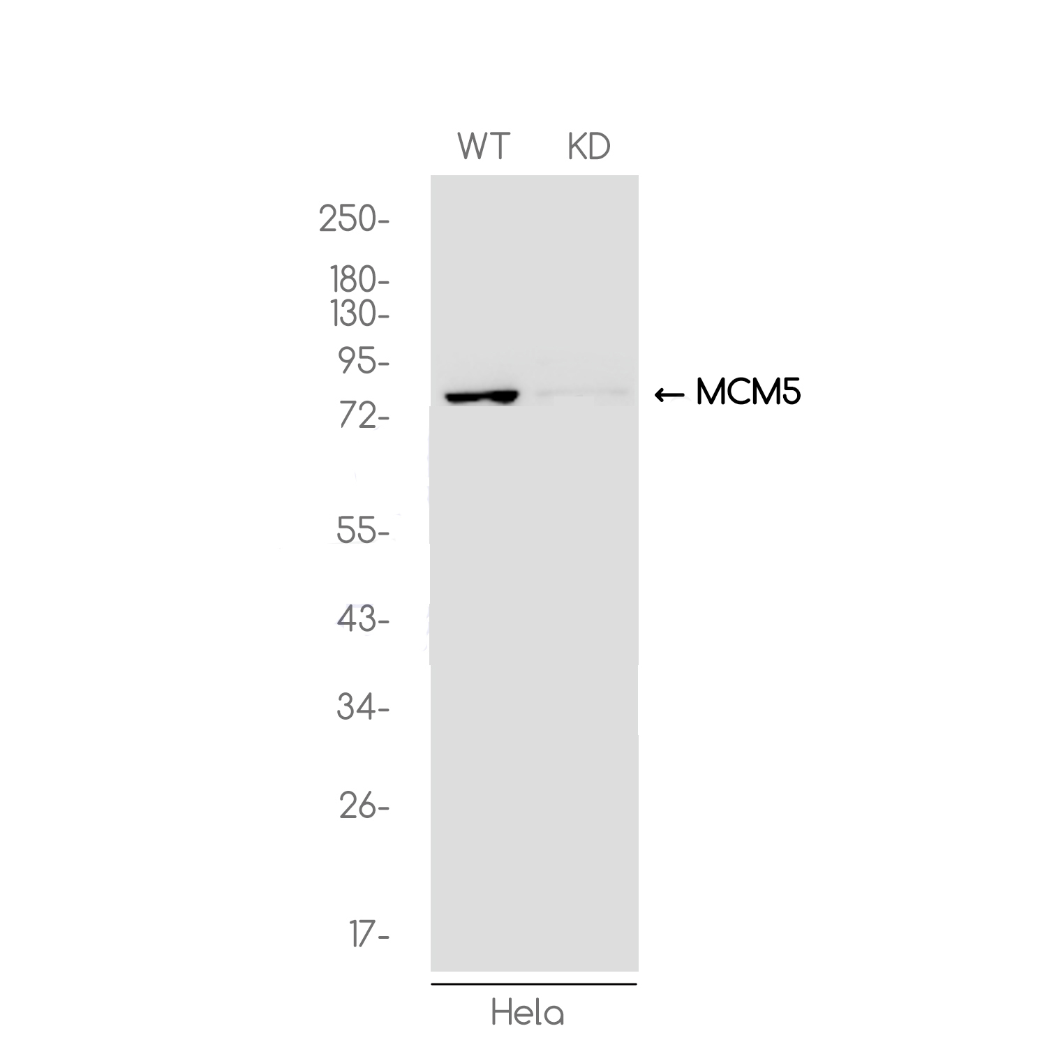[KD]MCM5 Rabbit mAb ABZ4687