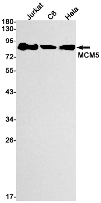 [KD]MCM5 Rabbit mAb ABZ4687