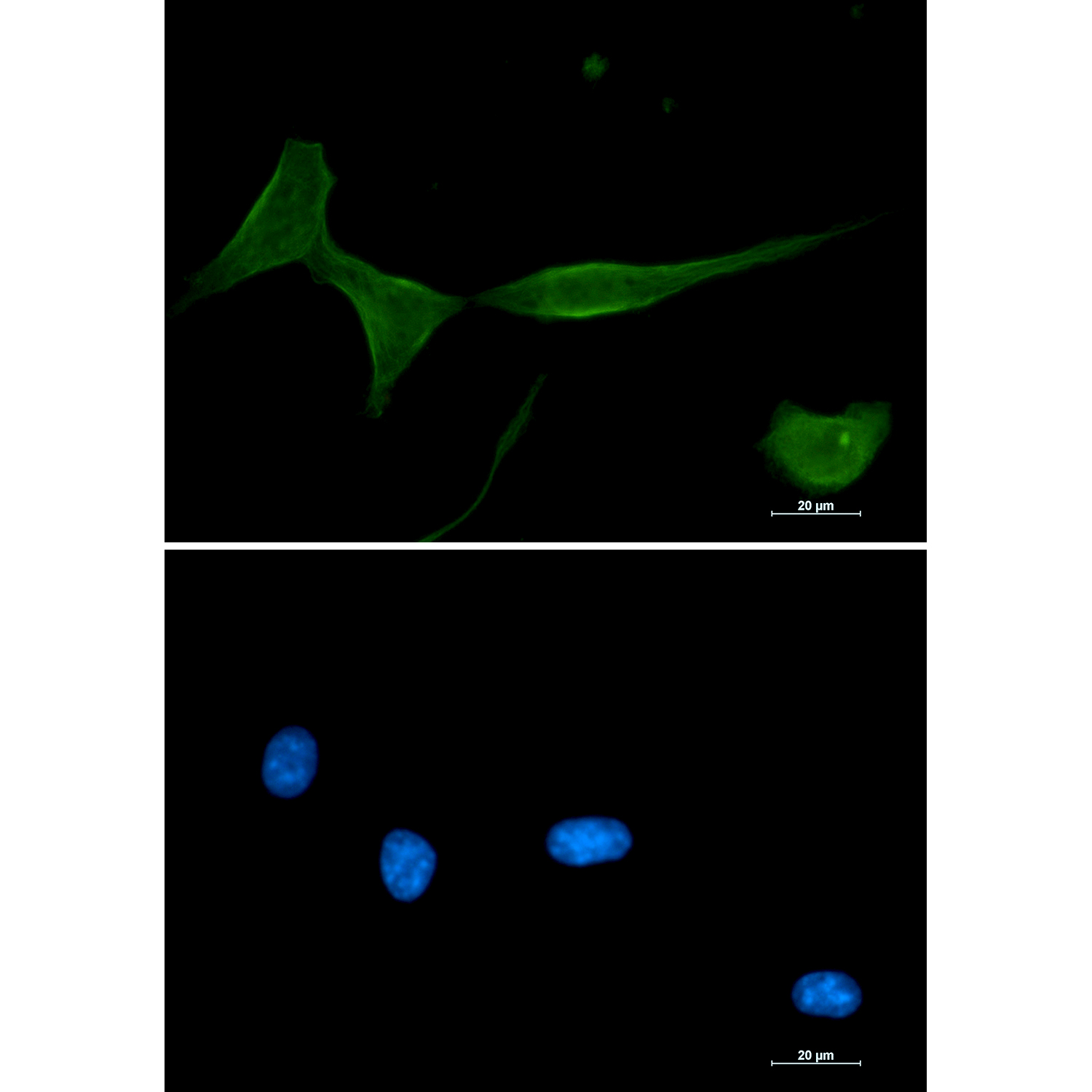 [KD]PKC delta Rabbit mAb ABZ4689